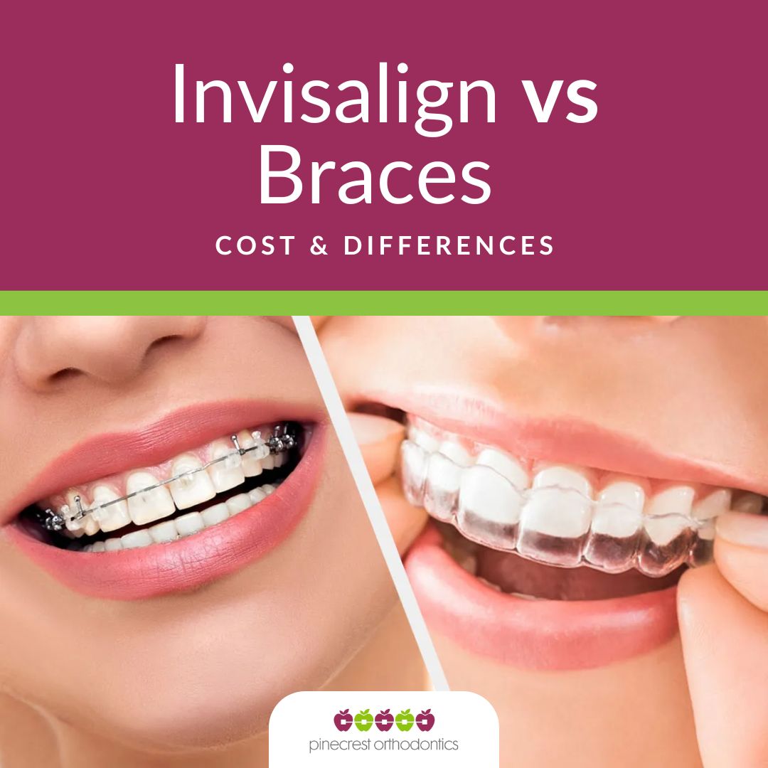 Invisalign vs Braces Cost smiling patient teeth banner ig