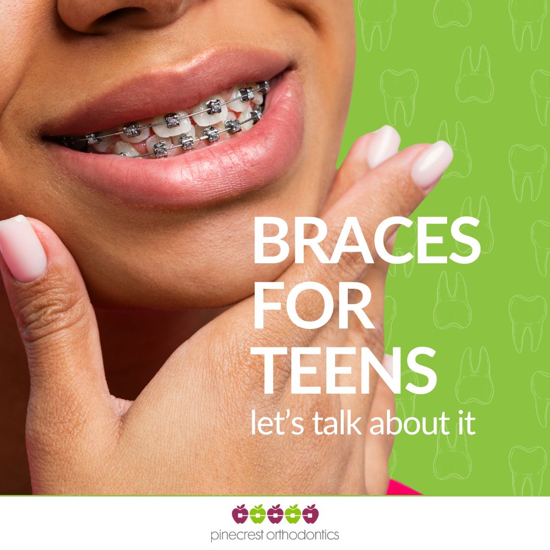 Braces for Teens in Pinecrest Miami - IG